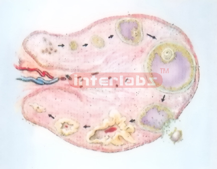 HANGING HUMAN OVARY ANATOMY MODEL